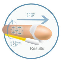 Androextender Penisverlängerung Andromedical 8065